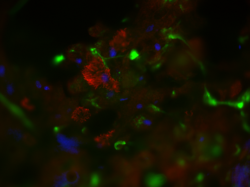 Epifluorescent microscopy of ciliated and goblet cells.