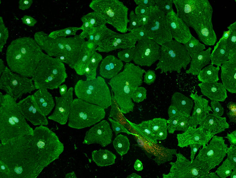 Fluorescent microscopy of cardiomyocytes.