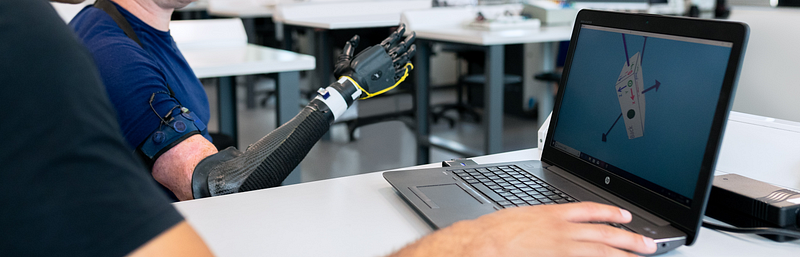 Proprioceptive prosthetics enhancing user experience