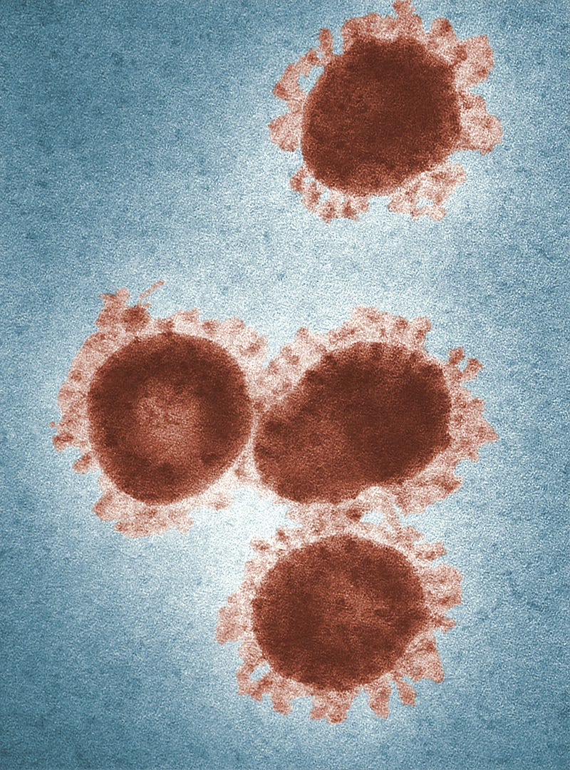 Influenza Virus Strains